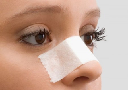 Rinoplastia – Cirurgia Plástica no Nariz rinoplastia