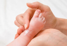 Melhor Pomada para Assadura 2025 Melhor Pomada para Assadura 2025